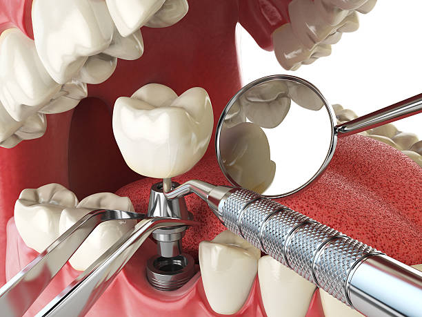 Trusted GA Emergency Dental Service Experts
